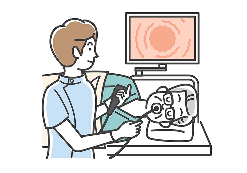 上部消化管内視鏡検査(胃カメラ)